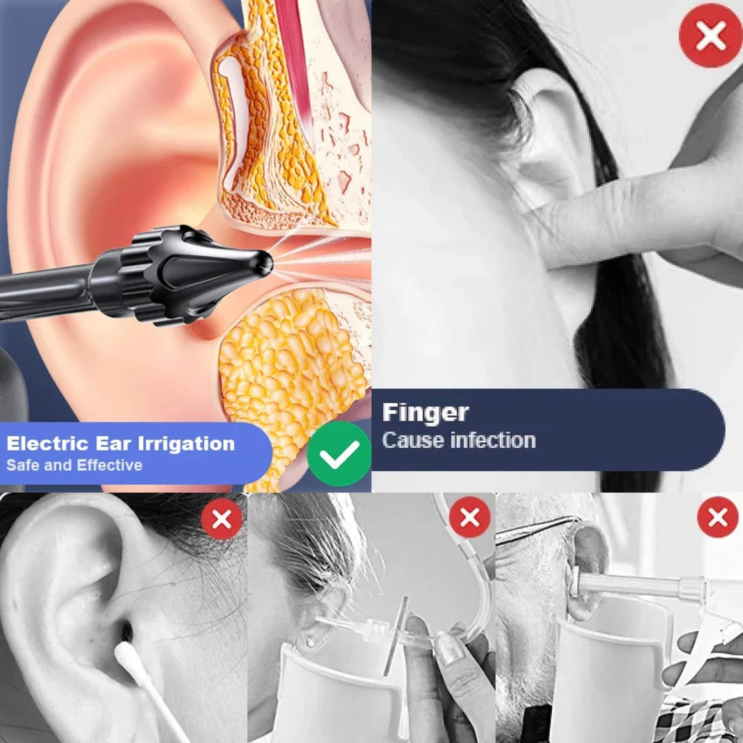 Harwelton™ Rechargeable Ear Cleaning Irrigation Tool with 3 Pressure Settings
